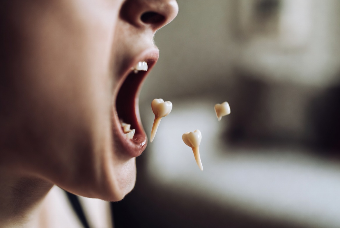 Teeth Falling Out & Crumbling Dream: What It Really Means